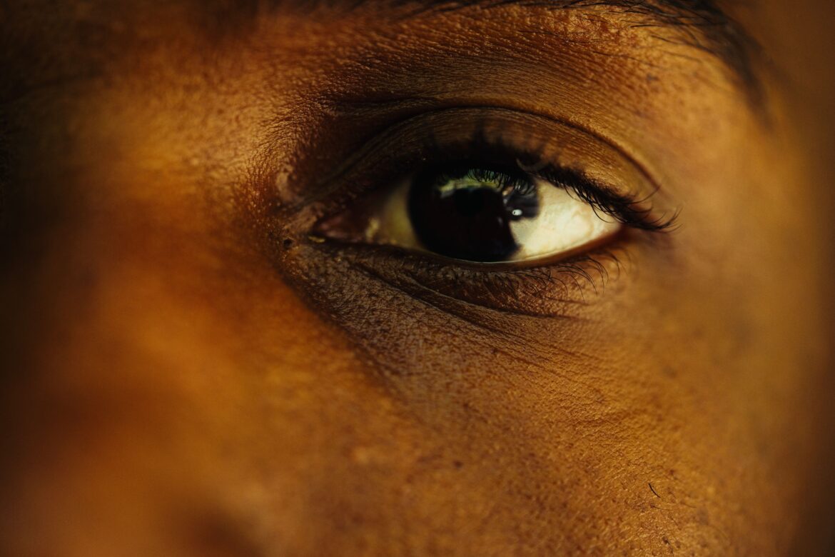 Personne présentant des symptômes de conjonctivite oculaire